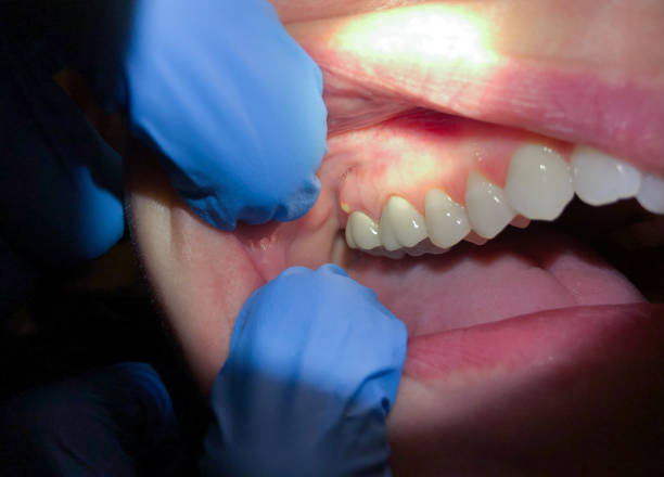 Best Emergency Treatment for Toothache in Crewe, VA